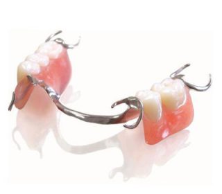 Removable partial dentures